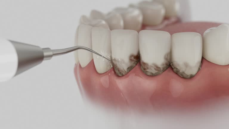 Reliable Dental contractor in Frazeysburg, OH by Dentist Open Now